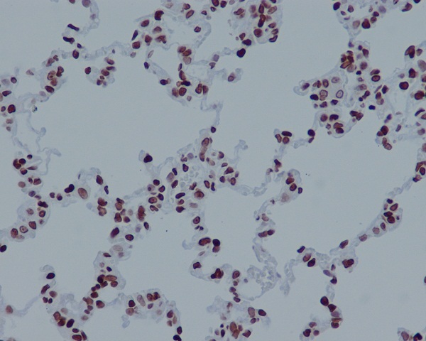 Immunohistochemical analysis of paraffin-embedded rat lung, using Histone H4 (acetyl K16) Antibody.