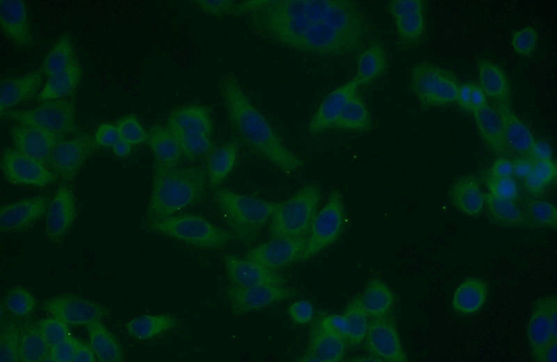 Immunofluorescent analysis of HeLa cells using Catalog No:115415(SMAD1 Antibody) at dilution of 1:25 and Alexa Fluor 488-congugated AffiniPure Goat Anti-Rabbit IgG(H+L)