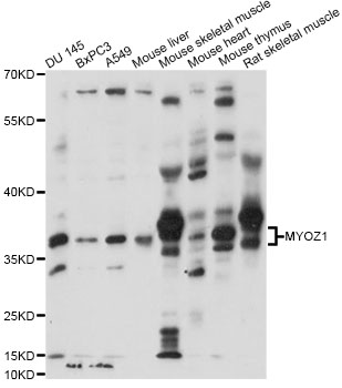 Western blot - MYOZ1 Polyclonal Antibody 