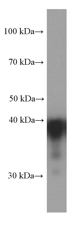 Jurkat cells were subjected to SDS PAGE followed by western blot with Catalog No:107031(CAPG Antibody) at dilution of 1:1000