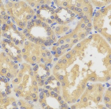 Immunohistochemistry - SMYD5 Polyclonal Antibody 