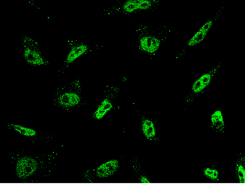 Human ARID1B Immunofluorescence(IF) 15842