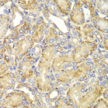 Immunohistochemistry - PPP2R2A Polyclonal Antibody 
