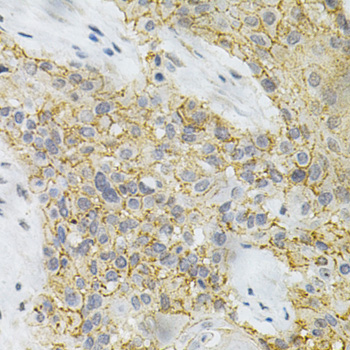 Immunohistochemistry - PPP2R4 Polyclonal Antibody 