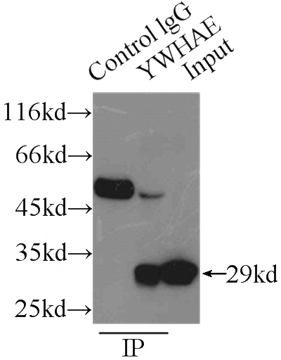 IP Result of anti-14-3-3E (IP:Catalog No:107659, 3ug; Detection:Catalog No:107659 1:1000) with A375 cells lysate 6000ug.