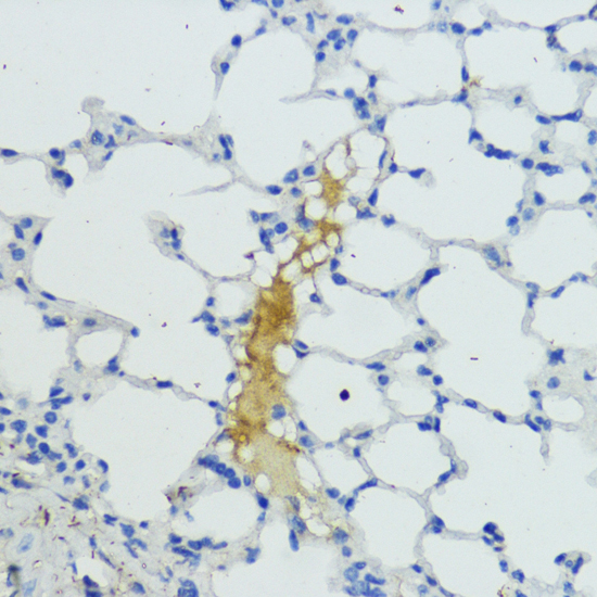 Immunohistochemistry - KLKB1 Polyclonal Antibody 
