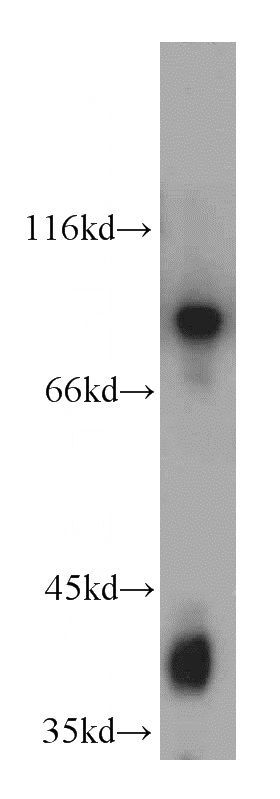 human brain tissue were subjected to SDS PAGE followed by western blot with Catalog No:113701(PCDHGB3 antibody) at dilution of 1:400