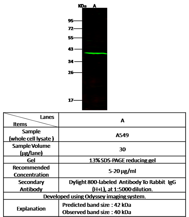 CD62L / L-Selectin Antibody, Rabbit PAb, Antigen Affinity Purified, Western blot