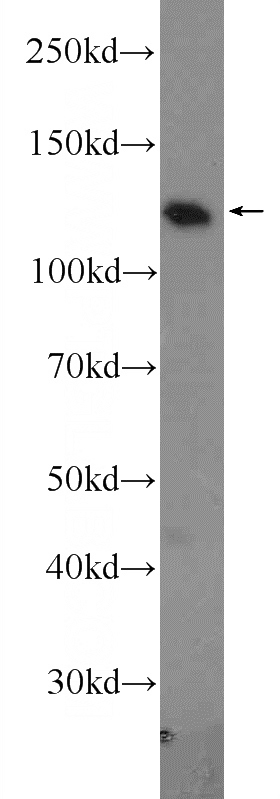 PC-13 cells were subjected to SDS PAGE followed by western blot with Catalog No:110214(KIF11 Antibody) at dilution of 1:1000