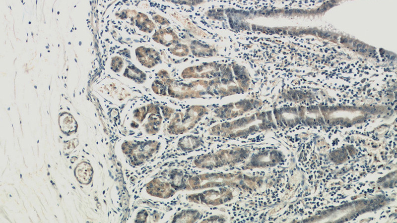 Immunohistochemical of paraffin-embedded human stomach using Catalog No:107980(ALG13 antibody) at dilution of 1:100 (under 10x lens)