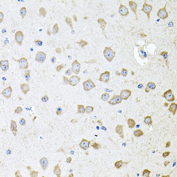 Immunohistochemistry - AKAP5 Polyclonal Antibody 