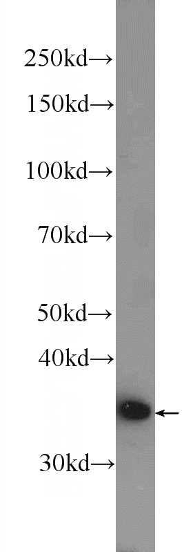 HEK-293 cells were subjected to SDS PAGE followed by western blot with Catalog No:107850(AIDA Antibody) at dilution of 1:600
