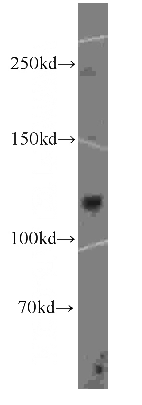K-562 cells were subjected to SDS PAGE followed by western blot with Catalog No:107241(DGCR8 antibody) at dilution of 1:1000