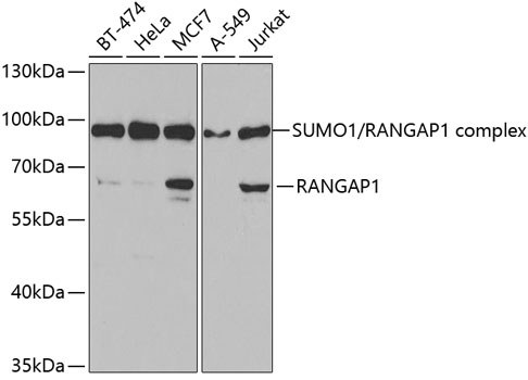 Western blot - RANGAP1 Polyclonal Antibody 