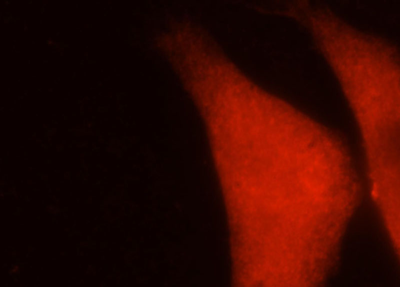 Immunofluorescent analysis of HepG2 cells, using PBK antibody Catalog No:113612 at 1:25 dilution and Rhodamine-labeled goat anti-rabbit IgG (red).