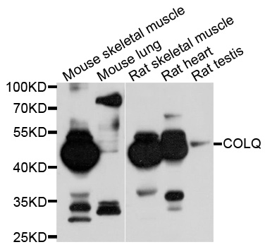 Western blot - COLQ Polyclonal Antibody 