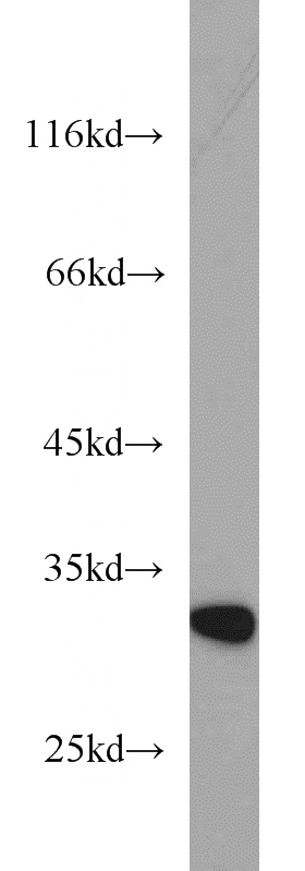 mouse placenta tissue were subjected to SDS PAGE followed by western blot with Catalog No:114854(RSU1 antibody) at dilution of 1:300
