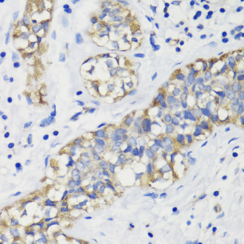 Immunohistochemistry - DEPDC6 Polyclonal Antibody 