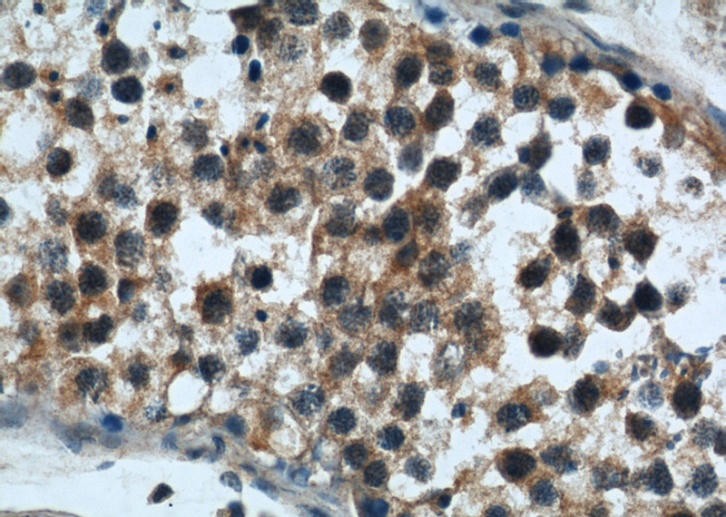 Immunohistochemical of paraffin-embedded human testis using Catalog No:114492(ZFYVE20 antibody) at dilution of 1:50 (under 40x lens)