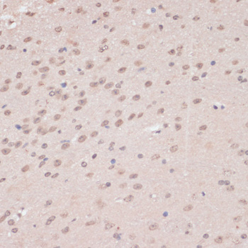 Immunohistochemistry - PRPF31 Polyclonal Antibody 