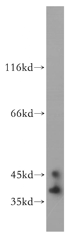 mouse cerebellum tissue were subjected to SDS PAGE followed by western blot with Catalog No:110273(ELAVL2 antibody) at dilution of 1:3000