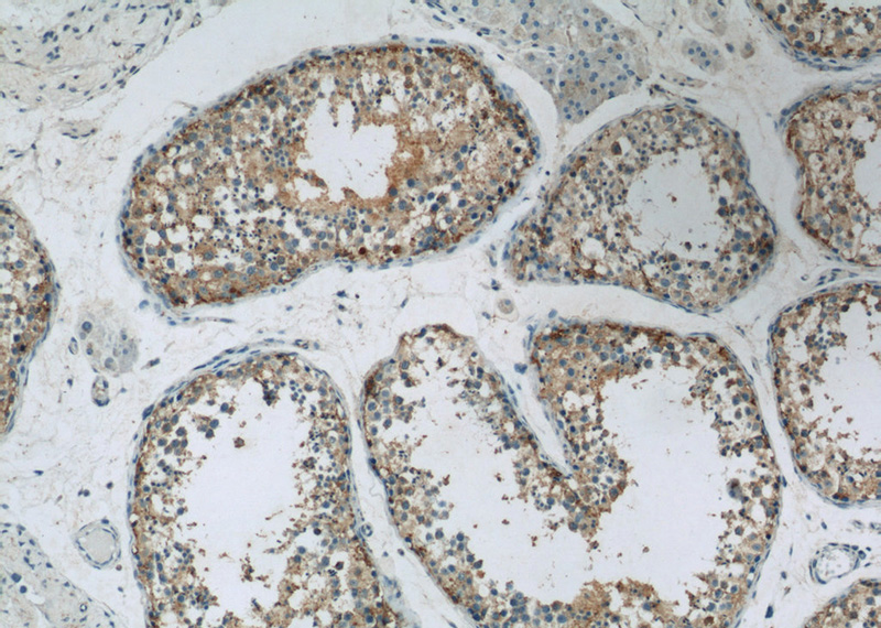 Immunohistochemistry of paraffin-embedded human testis slide using Catalog No:116658(UBQLN2 Antibody) at dilution of 1:50