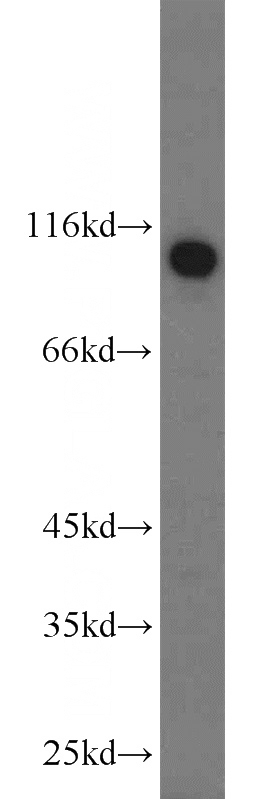 HepG2 cells were subjected to SDS PAGE followed by western blot with Catalog No:117266(ZSCAN20 antibody) at dilution of 1:1500