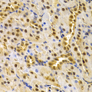 Immunohistochemistry - CDC25A Polyclonal Antibody 