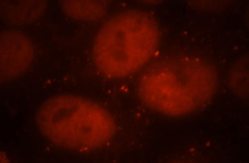 Immunofluorescent analysis of HepG2 cells, using CDC7 antibody Catalog No:109112 at 1:25 dilution and Rhodamine-labeled goat anti-rabbit IgG (red).