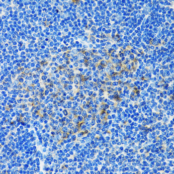 Immunohistochemistry - PAICS Polyclonal Antibody 