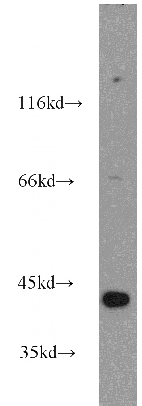 human brain tissue were subjected to SDS PAGE followed by western blot with Catalog No:113091(NECAB3 antibody) at dilution of 1:500