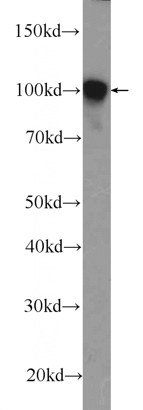 C6 cells were subjected to SDS PAGE followed by western blot with Catalog No:107865(a-Actinin Antibody) at dilution of 1:2000