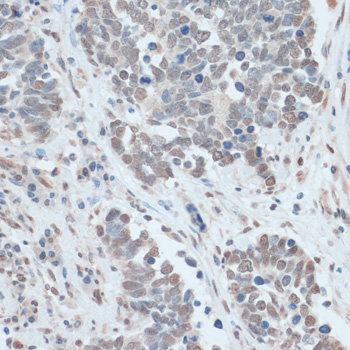 Immunohistochemistry - ZNF707 Polyclonal Antibody 