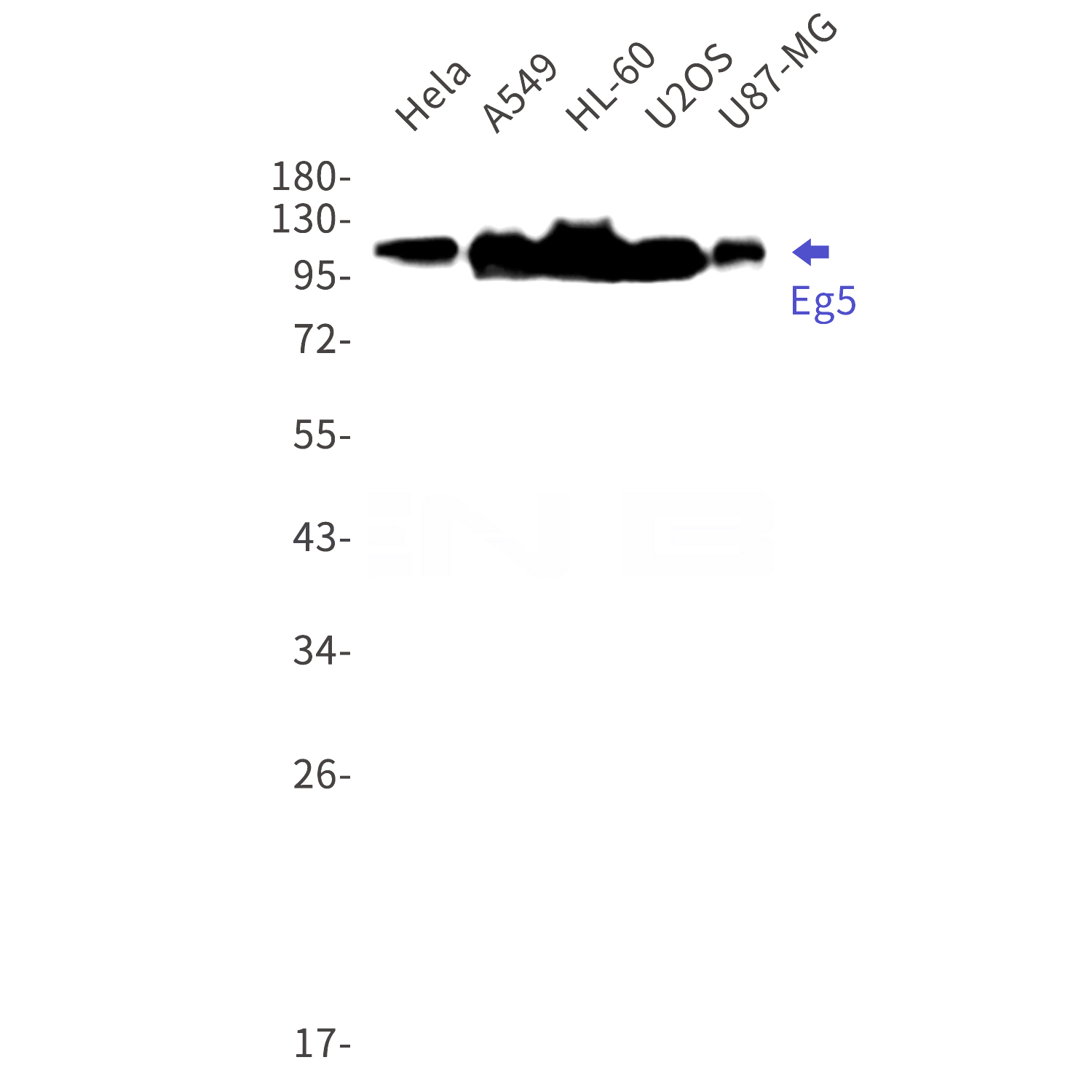 Western blot detection of Eg5 in Hela,A549,HL-60,U2OS,U87-MG cell lysates using Eg5 Rabbit mAb(1:1000 diluted).Predicted band size:119kDa.Observed band size:119kDa.
