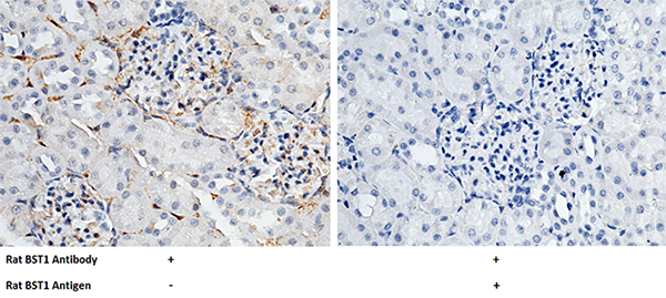 CD157 / BST1 Antibody, Rabbit PAb, Antigen Affinity Purified, Immunohistochemistry