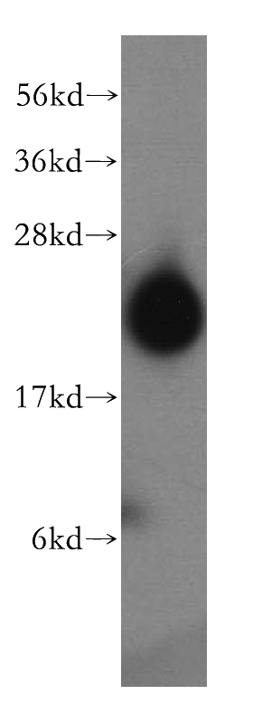 human brain tissue were subjected to SDS PAGE followed by western blot with Catalog No:109945(DIRAS2 antibody) at dilution of 1:500