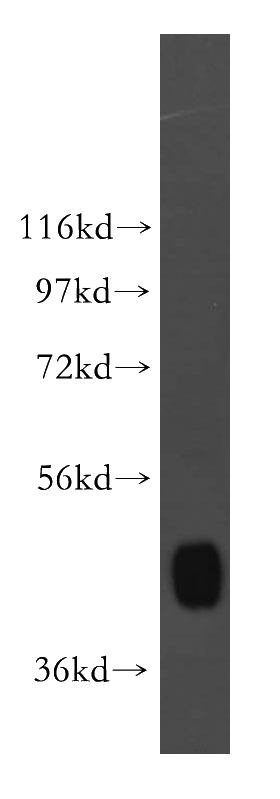 mouse heart tissue were subjected to SDS PAGE followed by western blot with Catalog No:110722(FLOT1 antibody) at dilution of 1:500