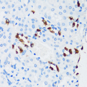 Immunohistochemistry - ATP6V1G3 Polyclonal Antibody 