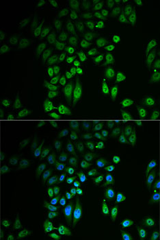 Immunofluorescence - GPLD1 Polyclonal Antibody 