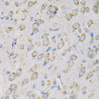 Immunohistochemistry - IL10RA Polyclonal Antibody 