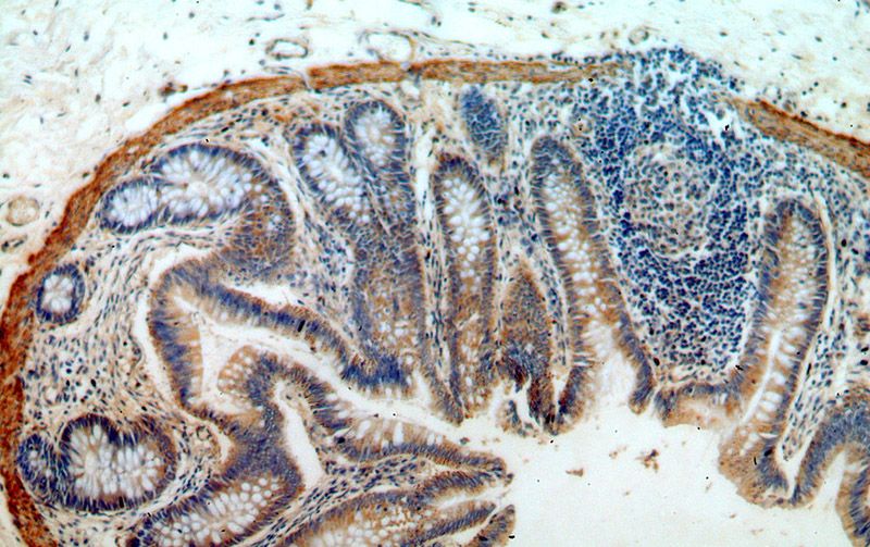 Immunohistochemical of paraffin-embedded human colon using Catalog No:108396(B4GALT6 antibody) at dilution of 1:100 (under 10x lens)