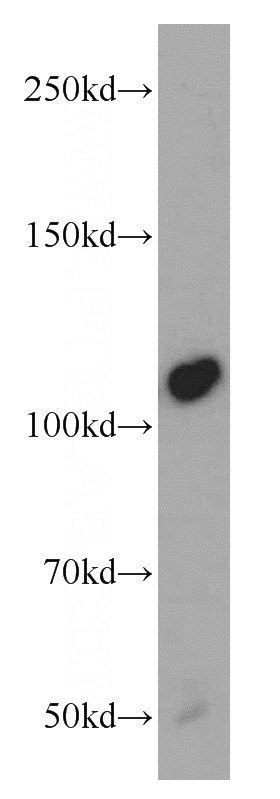 C6 cells were subjected to SDS PAGE followed by western blot with Catalog No:113096(NEDD4 antibody) at dilution of 1:300