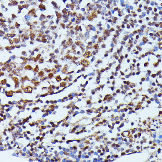 Immunohistochemistry - ID2 Polyclonal Antibody 
