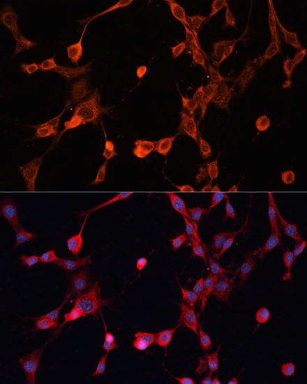 Immunofluorescence - P Glycoprotein Polyclonal Antibody 