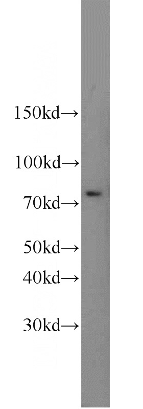 NIH/3T3 cells were subjected to SDS PAGE followed by western blot with Catalog No:115836(SUMO1 antibody) at dilution of 1:600
