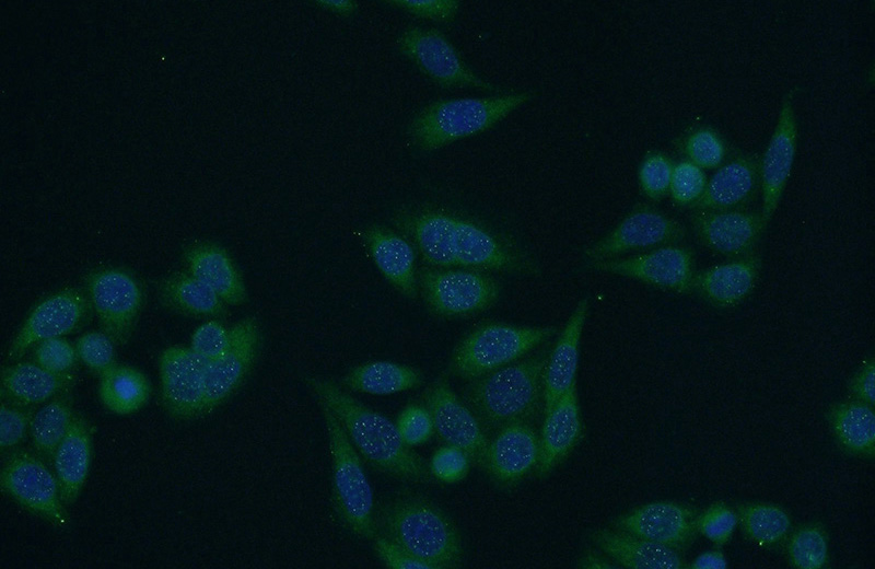 Immunofluorescent analysis of HeLa cells using Catalog No:116072(TLK2 Antibody) at dilution of 1:50 and Alexa Fluor 488-congugated AffiniPure Goat Anti-Rabbit IgG(H+L)