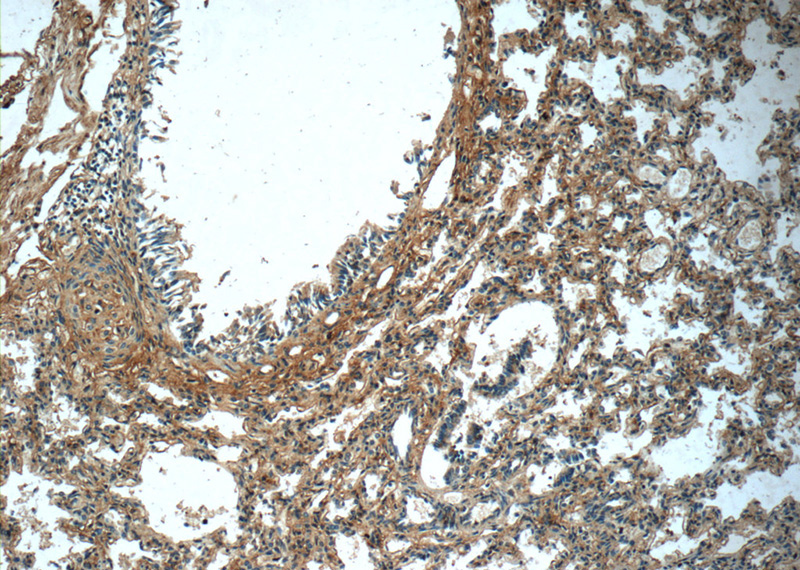 Immunohistochemistry of paraffin-embedded human lung tissue slide using Catalog No:114257(PTAFR Antibody) at dilution of 1:50 (under 10x lens)