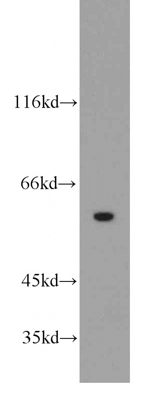 human brain tissue were subjected to SDS PAGE followed by western blot with Catalog No:114698(RIC8A antibody) at dilution of 1:300