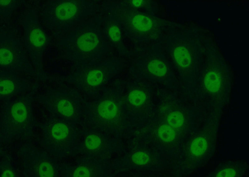 Immunofluorescent analysis of (10% Formaldehyde) fixed SH-SY5Y cells using Catalog No:109324(CITED2 Antibody) at dilution of 1:50 and Alexa Fluor 488-congugated AffiniPure Goat Anti-Rabbit IgG(H+L)