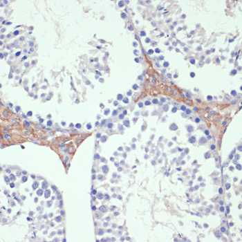 Immunohistochemistry - WNT5B Polyclonal Antibody 
